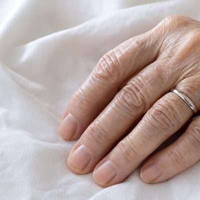 An eldery woman's hand with a ring on it.